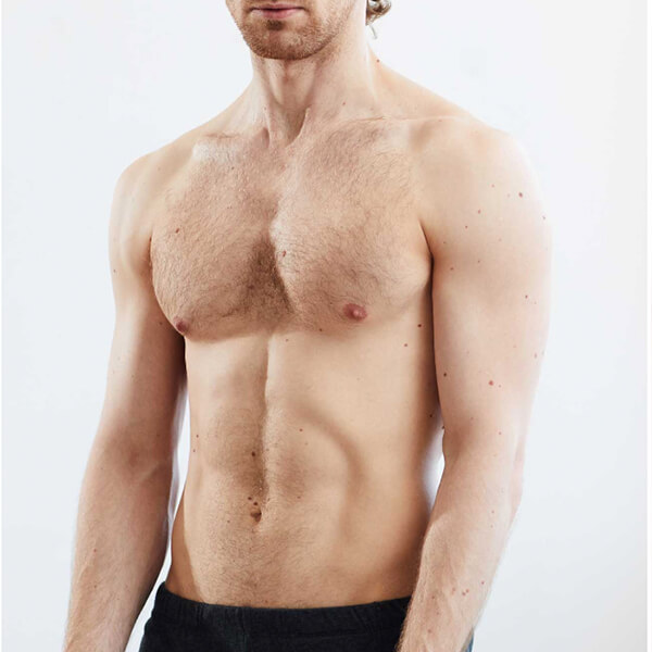 Ginecomastia Clinica Leblanc